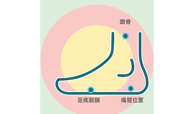 擷取